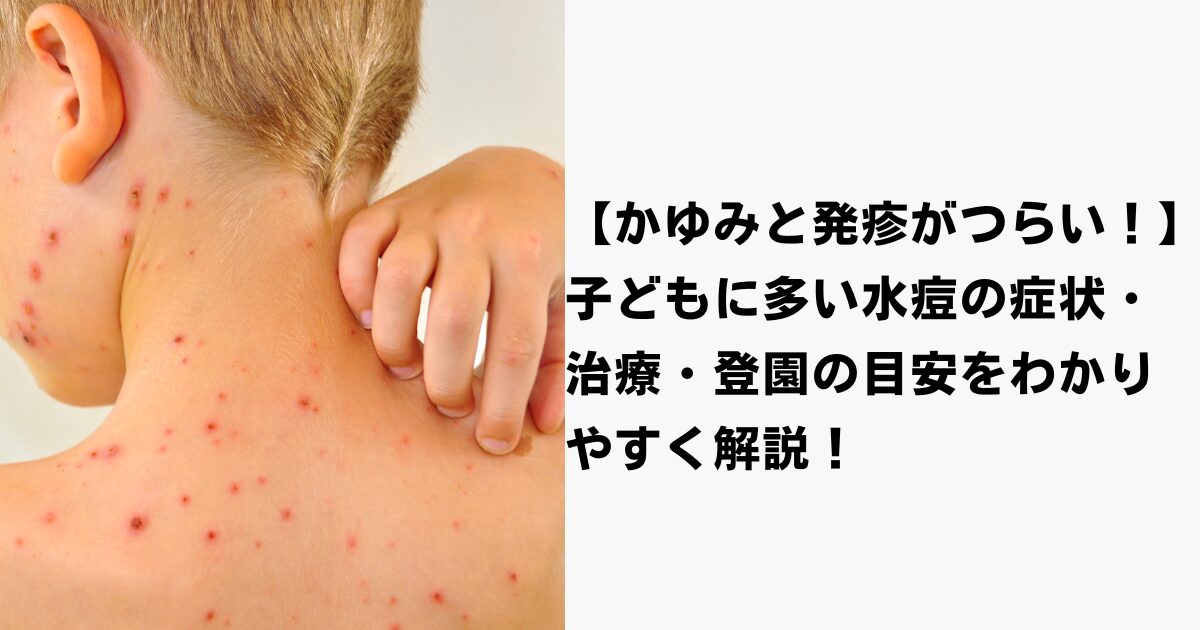 水ぼうそう
